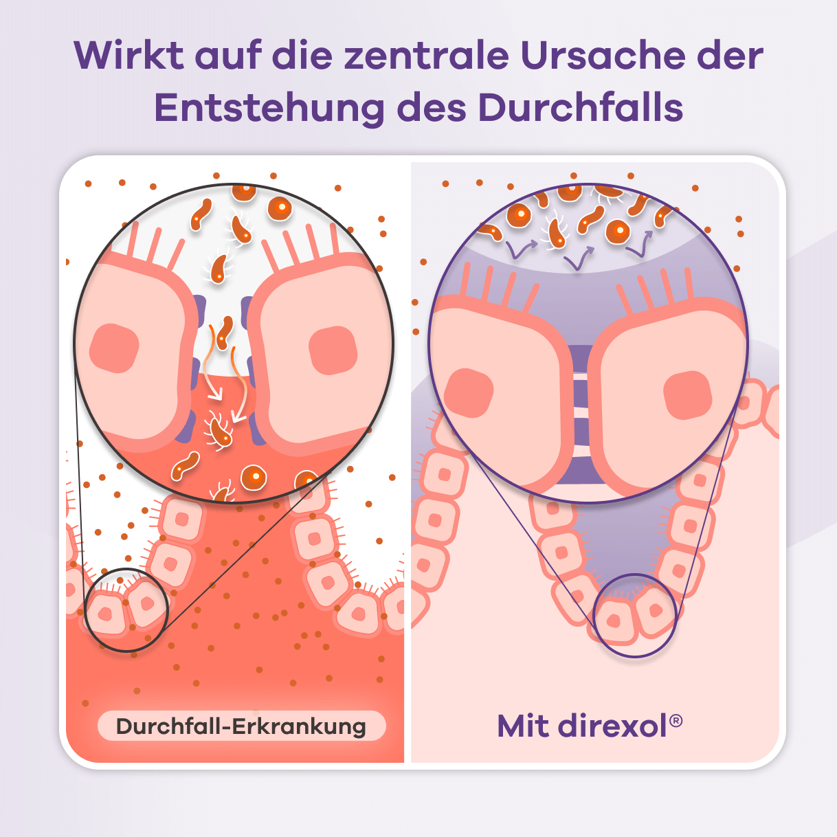 Infografik, die erklärt, wie Direxol wirkt. Der obere Text lautet: Wirkt auf die zentrale Ursache der Entstehung des Durchfalls. Links wird eine Durchfall-Erkrankung gezeigt: Eine geschwächte Darmbarriere lässt Bakterien und Partikel durch. Rechts wird der Effekt mit Direxol® dargestellt: Eine gestärkte Darmbarriere verhindert das Eindringen von Bakterien und Partikeln.