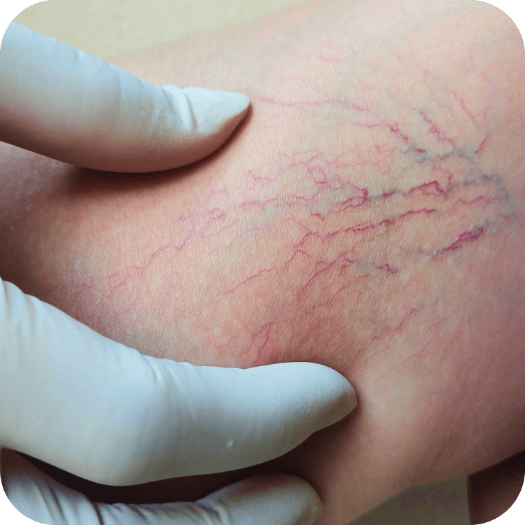 Beine einer Person mit weißen, strukturierten Hosen und braunen, geschnürten Sandalen mit Zierelementen. Die Beine sind auf einem grünen Untergrund übereinandergeschlagen.