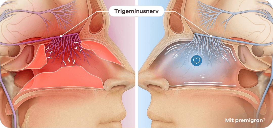 Anatomie: abschwellende Nebenhöhlen beruhigen den überaktiven Trigeminus-Nerv
