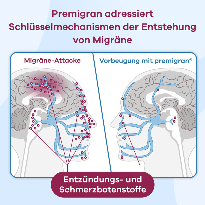 premigran® - Migräne vorbeugen & Schutz aufbauen
